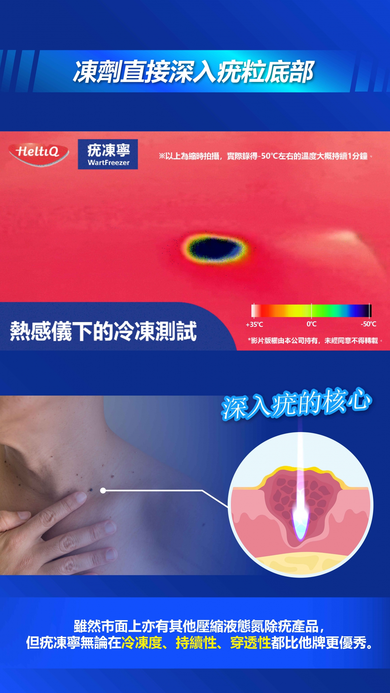 本頁圖片/檔案 - HeltiQ Blog_07